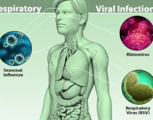 viral-infections-s6-respiratory-viral-infections